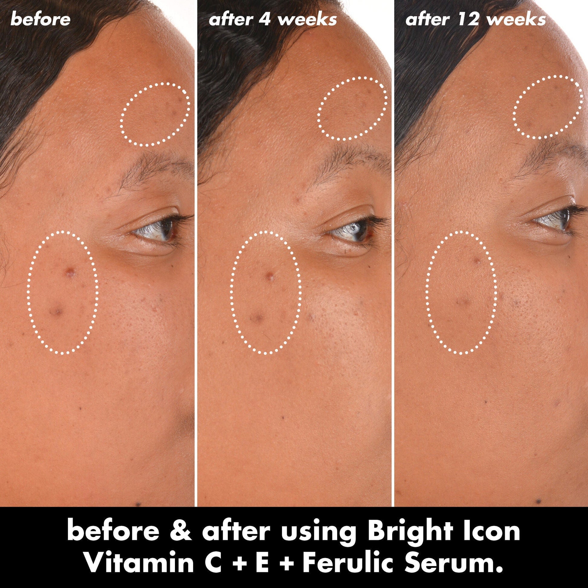 bright-icon-vitamin-c-e-ferulic-serum-f8 0226_EDU_BrightIconVitC_BA_Chanel_TRIPTYCH_c58f2fc8-209d-414f-9ba3-666a07a94887.jpg