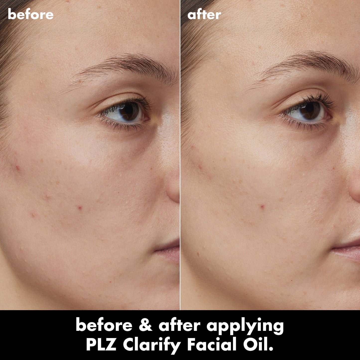 plz-clarify-facial-oil-y6 0326_EDU_PlzClarify_BA_Kelly.jpg