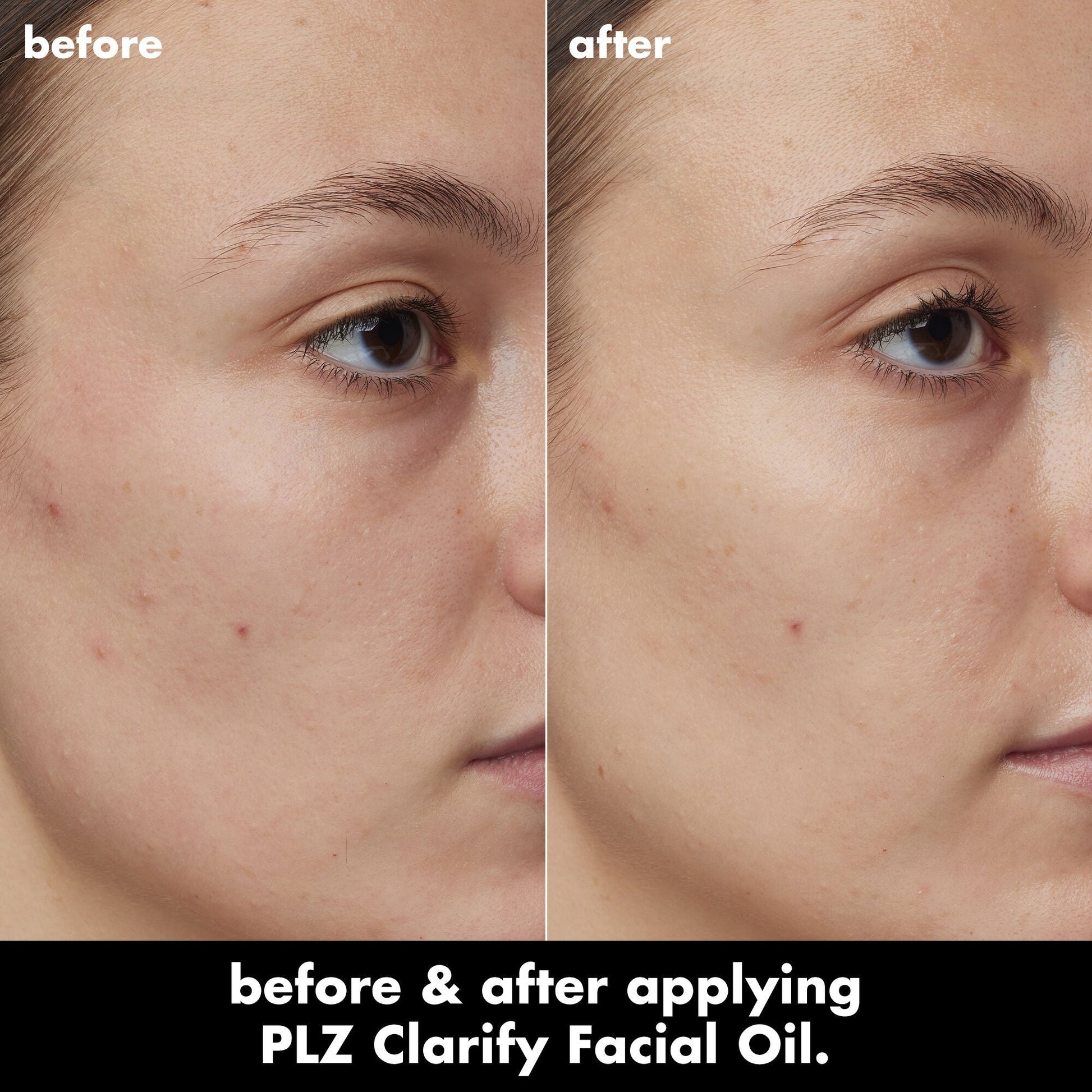 plz-clarify-facial-oil-y6 0326_EDU_PlzClarify_BA_Kelly.jpg