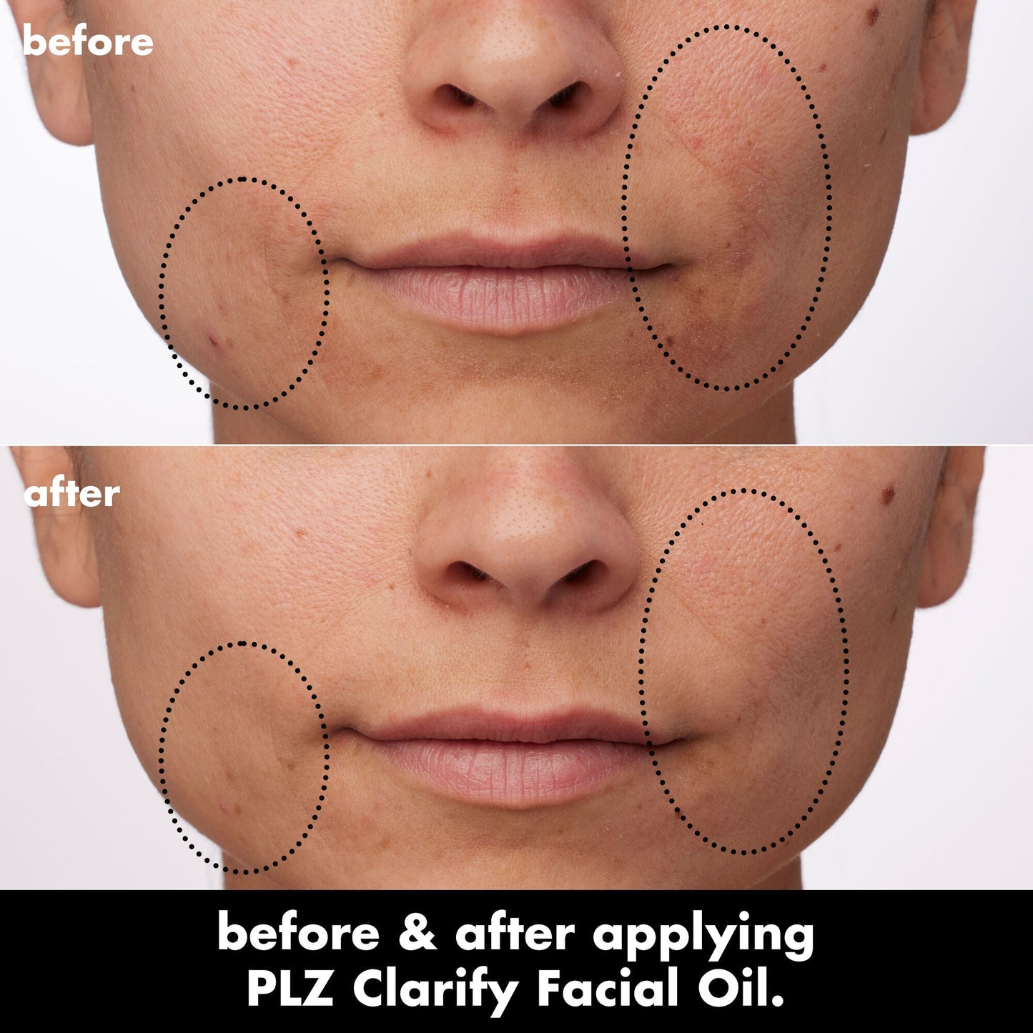 plz-clarify-facial-oil-y6 0326_EDU_PlzClarify_BA_Paula.jpg