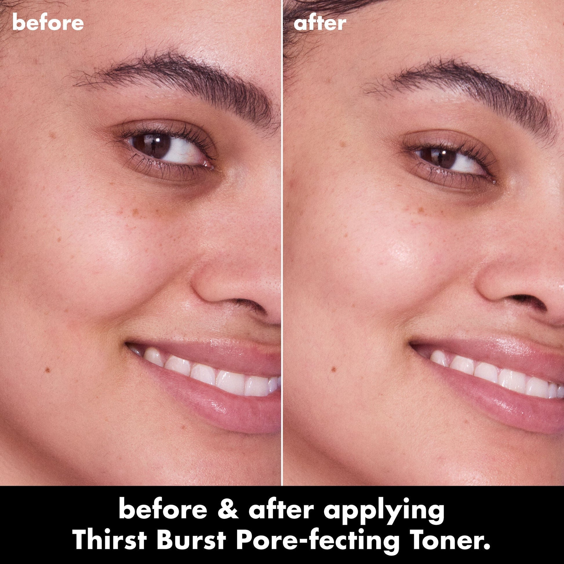 thirst-burst-pore-fecting-toner-h6 0326_EDU_THIRSTBURSTTONER_BA_Jade_5b0aaf31-8b58-4921-9f66-71e6ca0b8f83.jpg