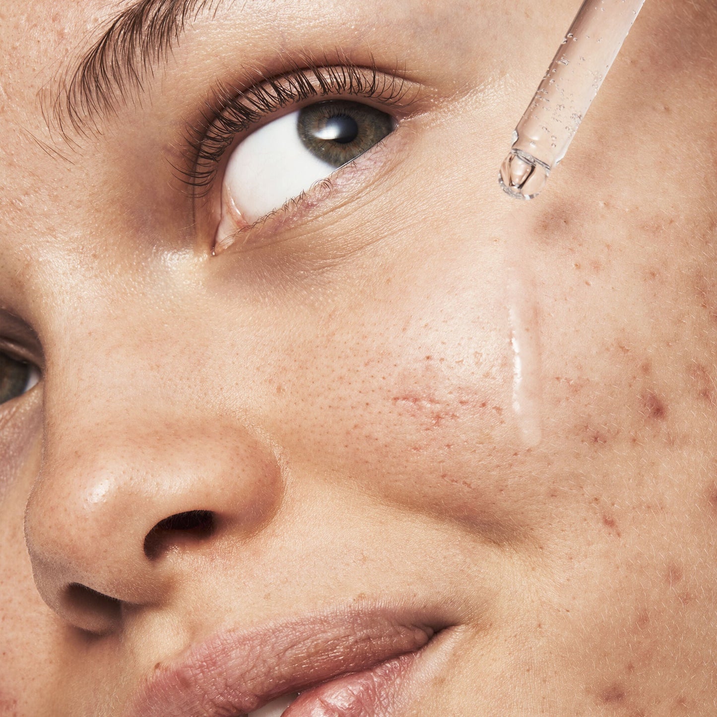 blemish-breakthrough-triple-acid-resurfacing-serum-y0 121321_Marley-Acne-Regimen_0254_FINAL_IGF.jpg