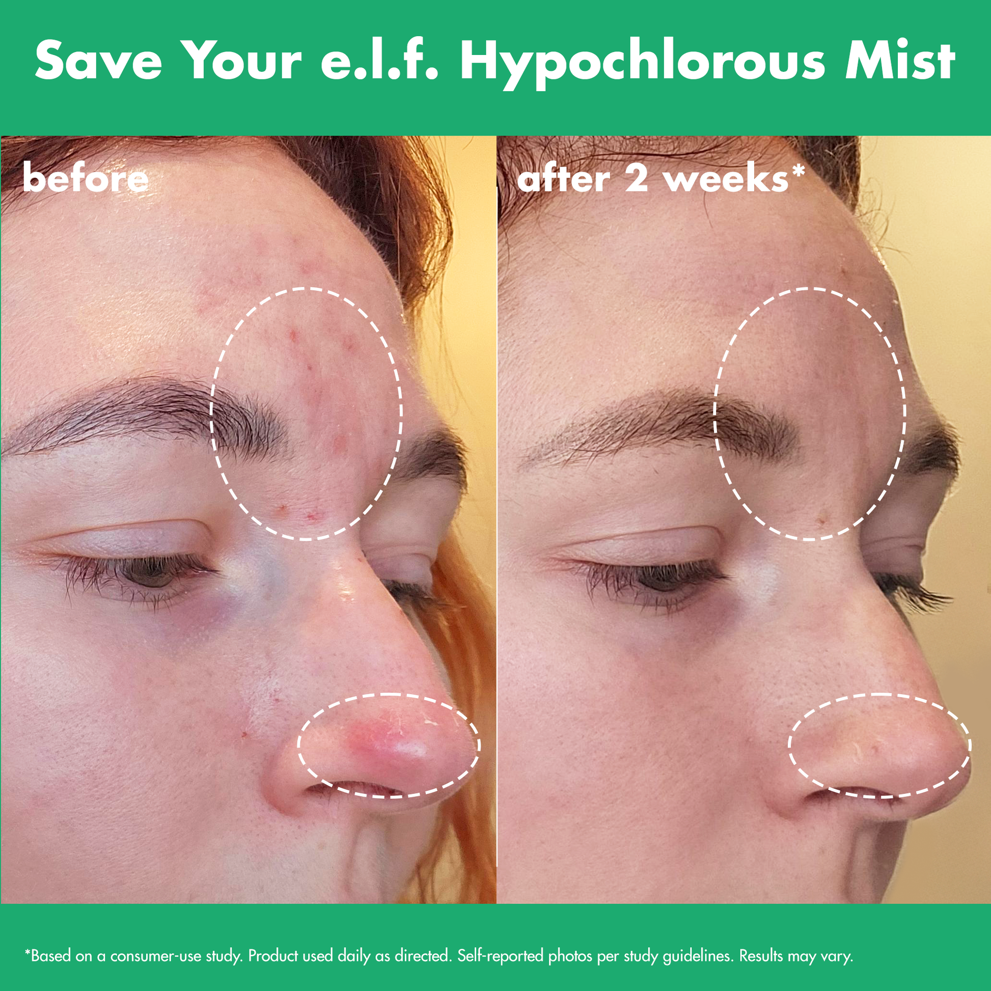 save-your-e-l-f-hypochlorous-mist-v7 FA26_EDUCATION_SAVEYOURELF_USAGE_BA1_WITHOUT_CLAIMS.png